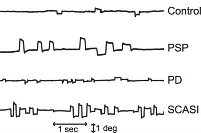 Modeling the Triggering of Saccades, Microsaccades, and Saccadic Intrusions